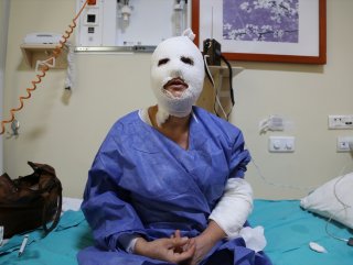 Düdüklü tencere hastanelik etti